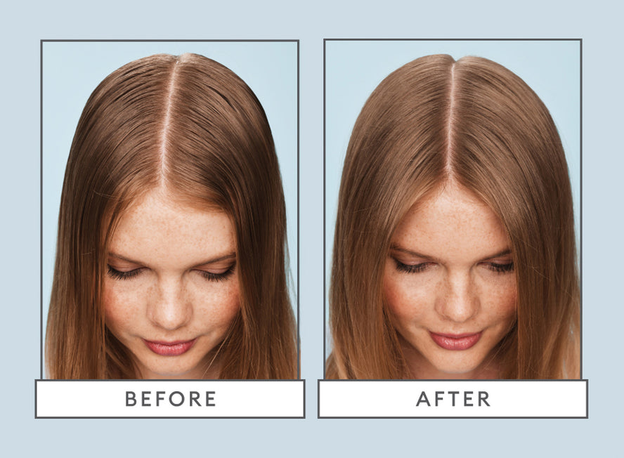 10 Causes Of Itchy Scalp And How To Relieve It