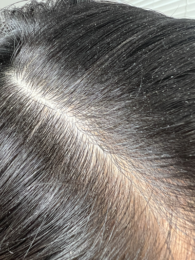 Blog - Buildup 101: Causes + Cures