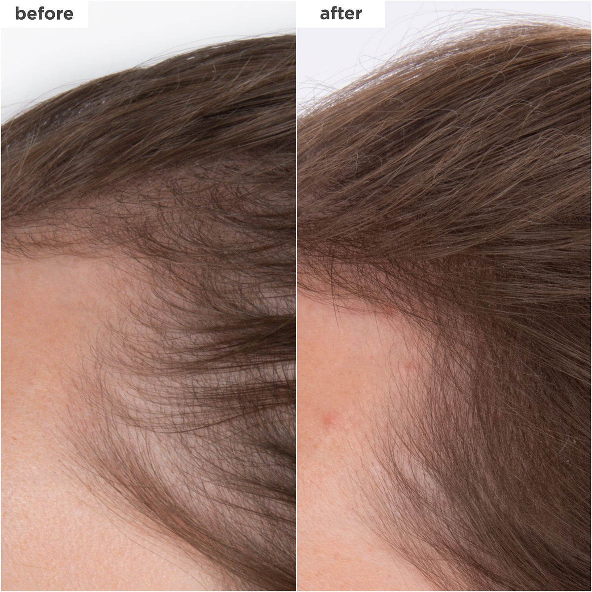 Destined For Density™ MegaStrength+ Caffeine + Biotin Peptide Density Serum