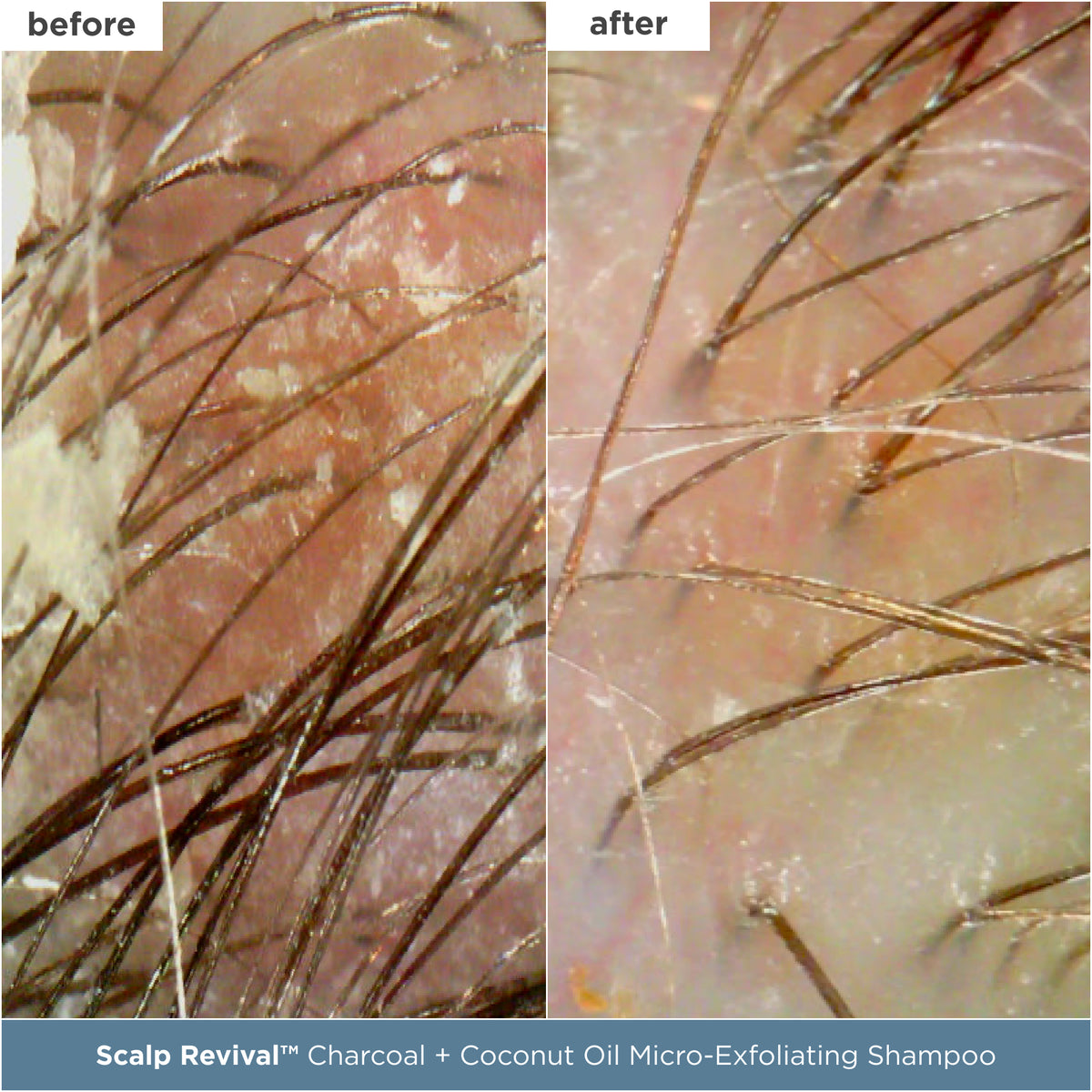 Scalp Care Essentials Featuring Scalp Revival™