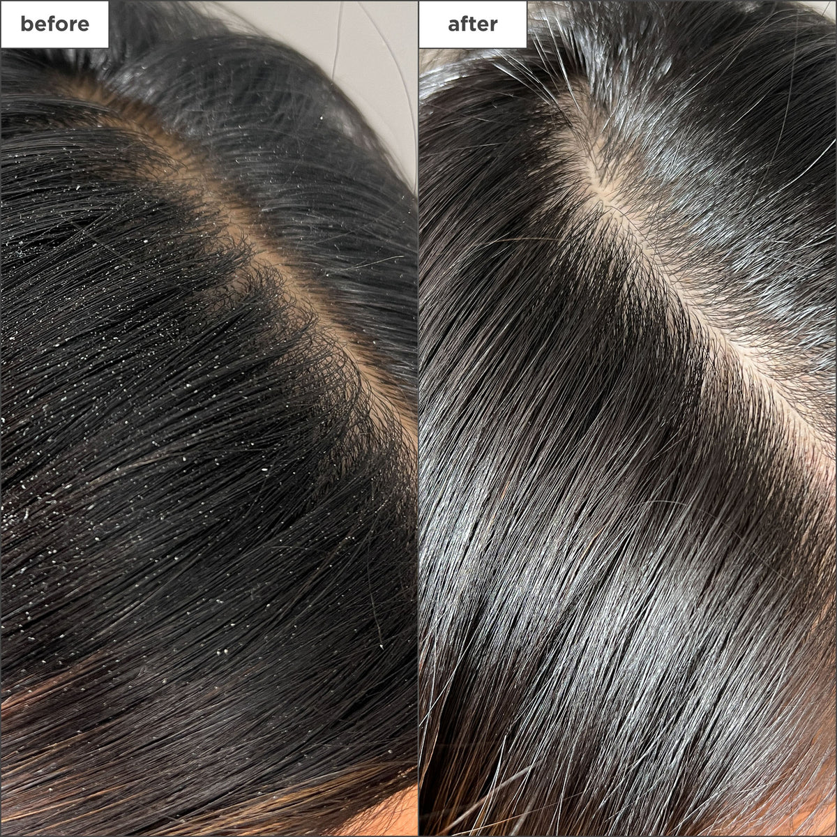 Scalp Revival Charcoal + Tea Tree Buildup Detox Spray