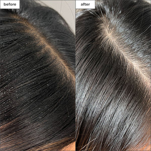 Scalp Revival Charcoal + Tea Tree Buildup Detox Spray