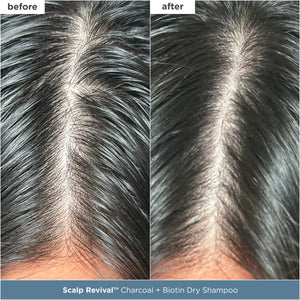 Scalp Care Essentials Featuring Scalp Revival™