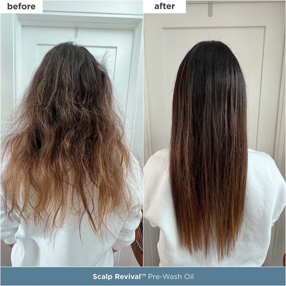 Scalp Soothing Starter Set™