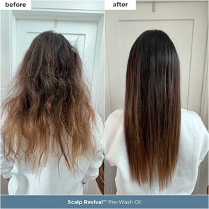 Scalp Soothing Starter Set™