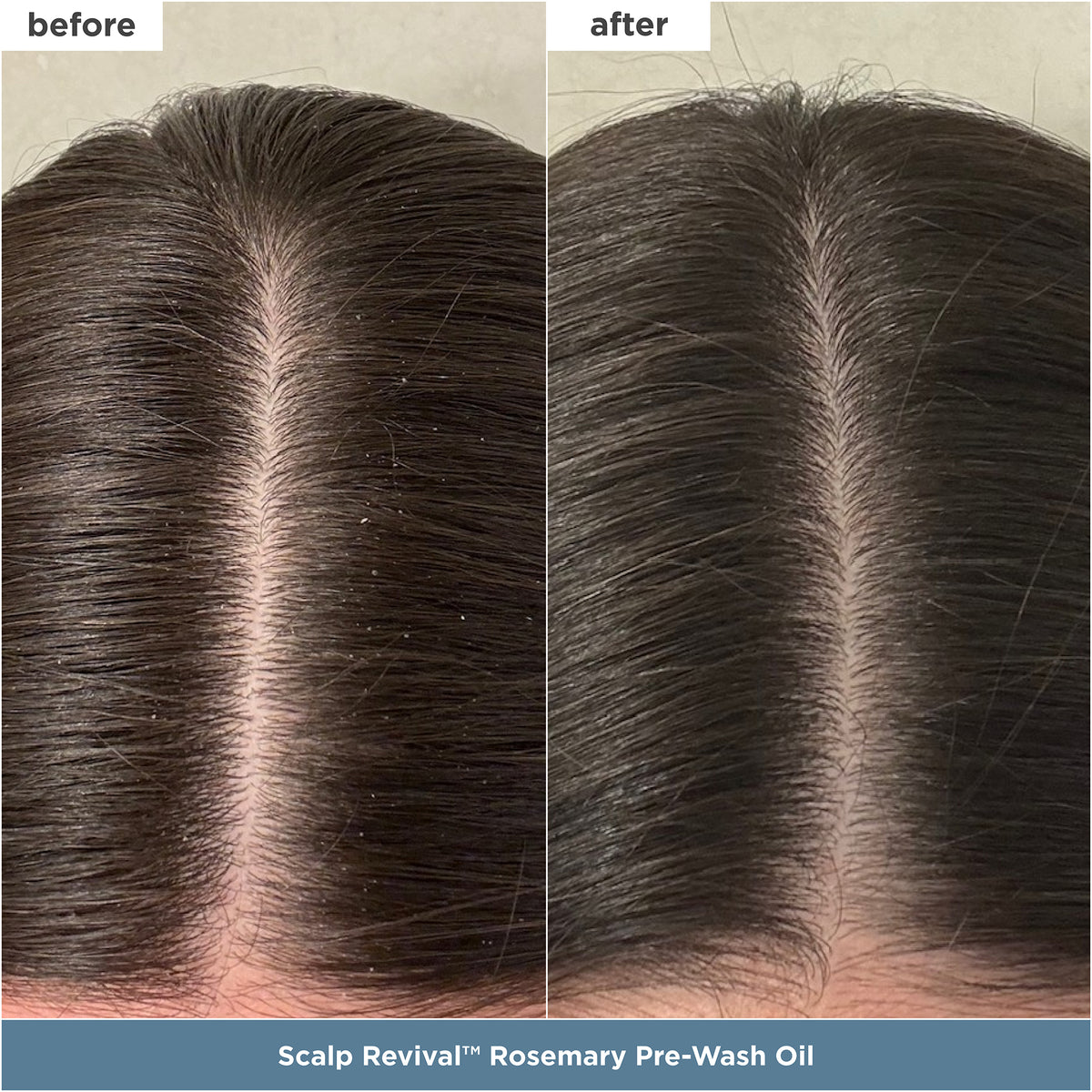 Healthy Hair Delights
