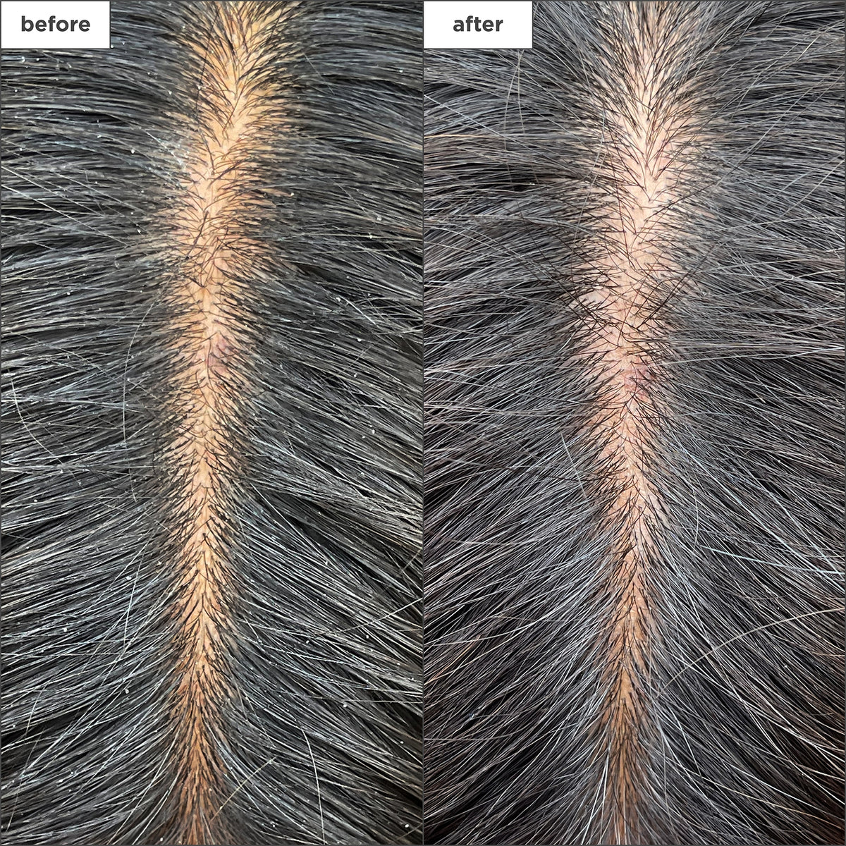Scalp Revival Charcoal + Tea Tree Cooling Hydration Scalp Mask