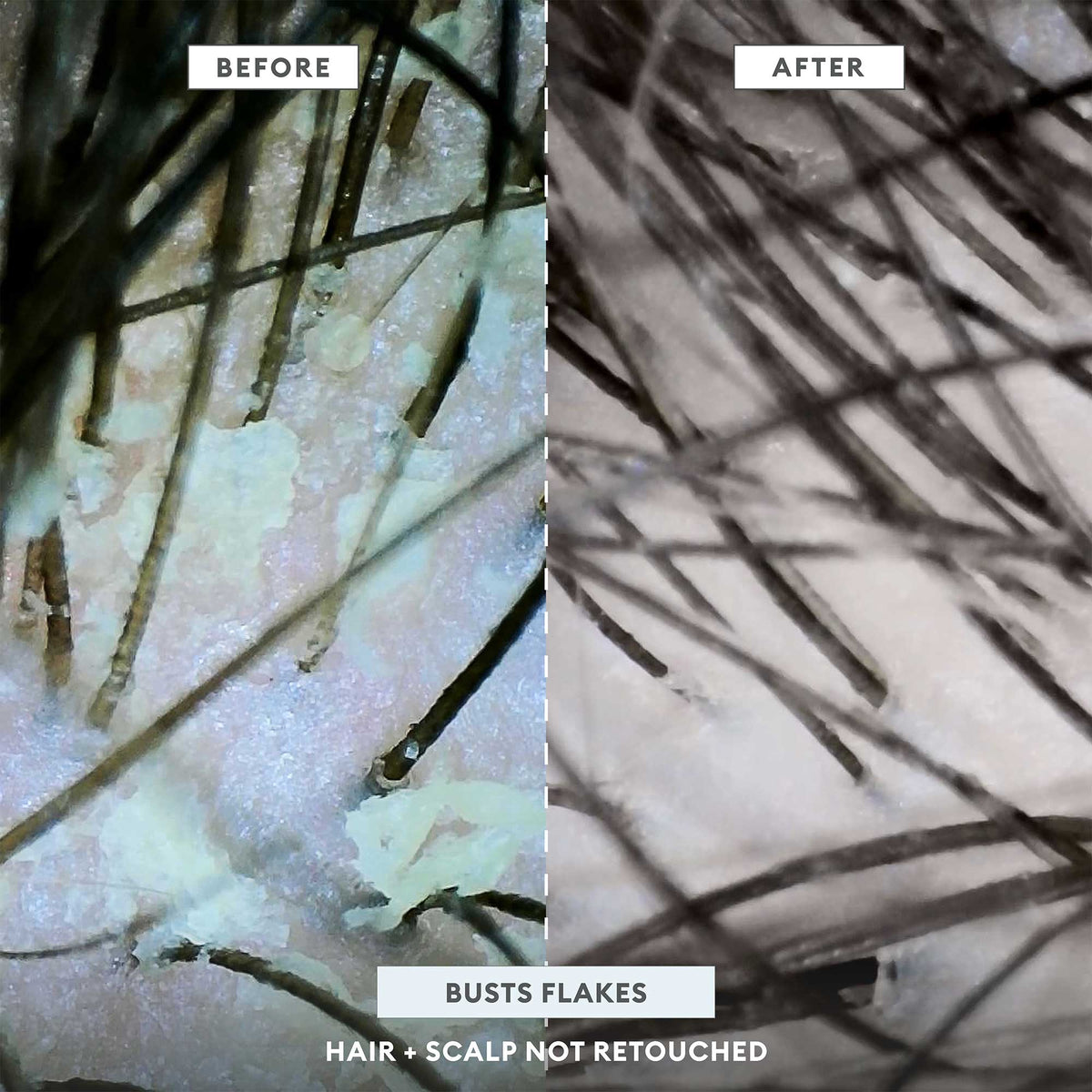 Scalp Revival™ Scrub + Hydration Duo