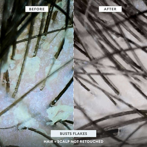 Scalp Revival™ Scrub + Hydration Duo