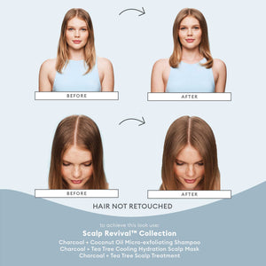 Scalp Revival™ Dandruff Relief Complete Set
