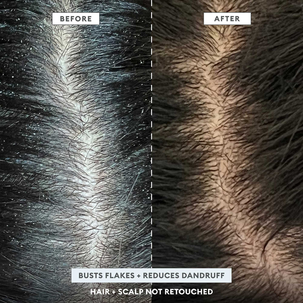 Scalp Revival™ Scrub + Hydration Duo