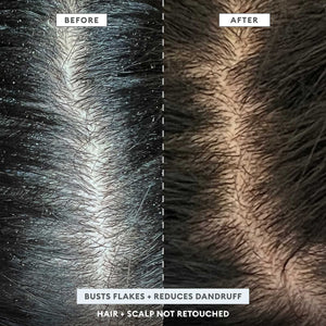 Scalp Revival™ Scrub + Hydration Duo