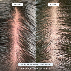 Scalp Revival™ Scrub + Hydration Duo