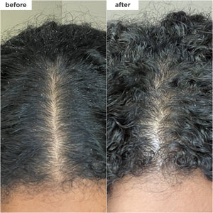 Scalp Revival™ Charcoal + Coconut Oil Micro-Exfoliating Shampoo | Scalp Scrub