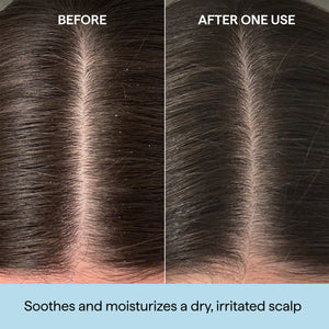 Scalp Revival™ Rosemary Pre-Wash Oil for Hair and Scalp