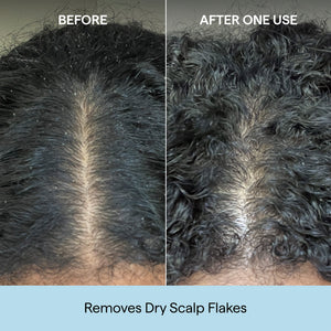 Scalp Revival™ Charcoal + Coconut Oil Micro-Exfoliating Shampoo, 2 oz
