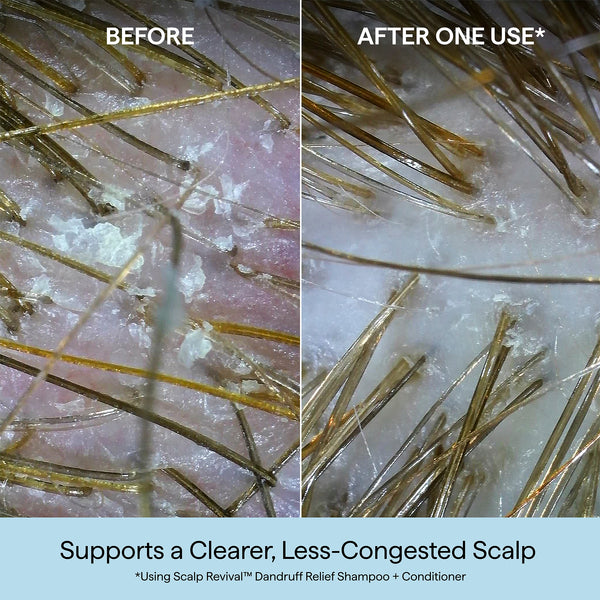 Scalp Revival™ Dandruff Relief Shampoo with Charcoal + 3% Salicylic Acid