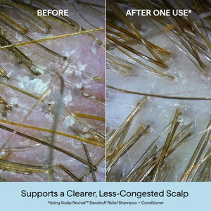 Scalp Revival™ Dandruff Relief Conditioner with Charcoal + 1.8% Salicylic Acid