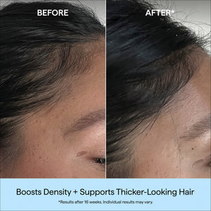 Destined For Density™ MegaStrength+ Caffeine + Biotin Peptide Density Serum
