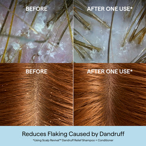 Scalp Revival™ Dandruff Relief Conditioner with Charcoal + 1.8% Salicylic Acid