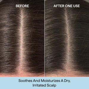 Scalp Revival™ Rosemary Pre-Wash Oil for Hair and Scalp