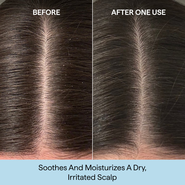 Scalp Revival™ Rosemary Pre-Wash Oil for Hair and Scalp
