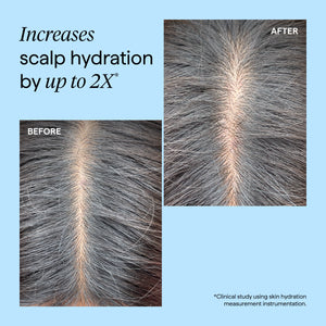 Scalp Revival Charcoal + Tea Tree Cooling Hydration Scalp Mask
