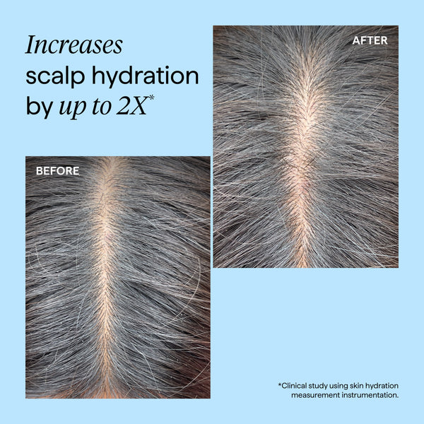 Scalp Revival Charcoal + Tea Tree Cooling Hydration Scalp Mask